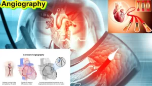 Angiography