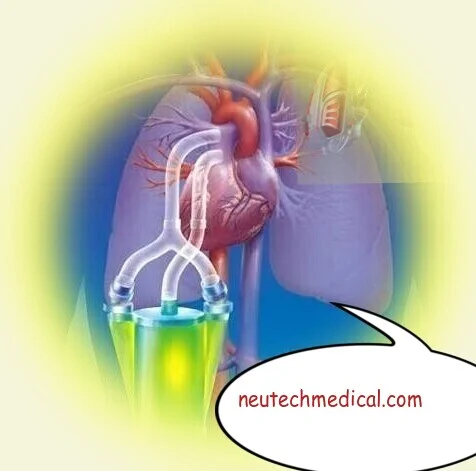 Artificial Lung