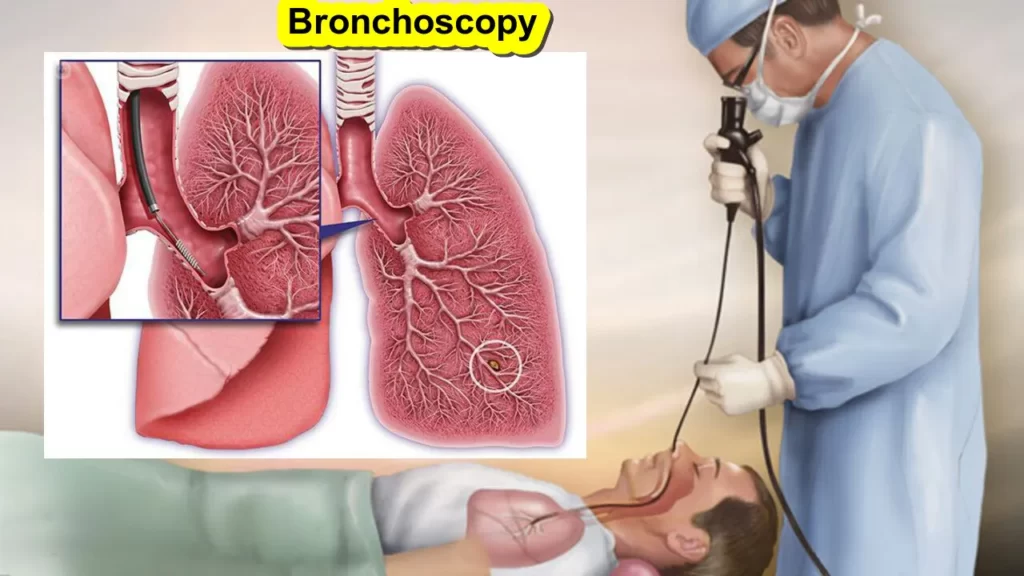 What is a Bronchoscopy