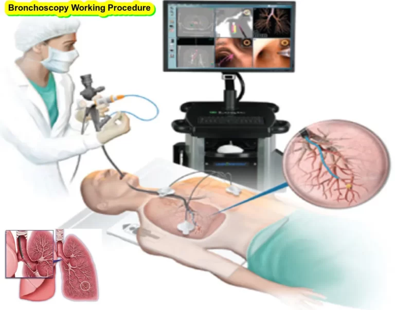 What is a Bronchoscopy