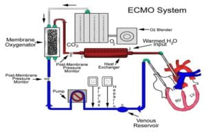 What is an ECMO Machine