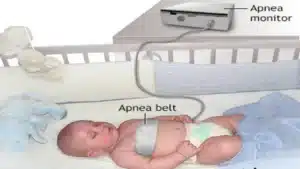 Apnea monitors