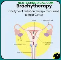 how to work brachytherapy