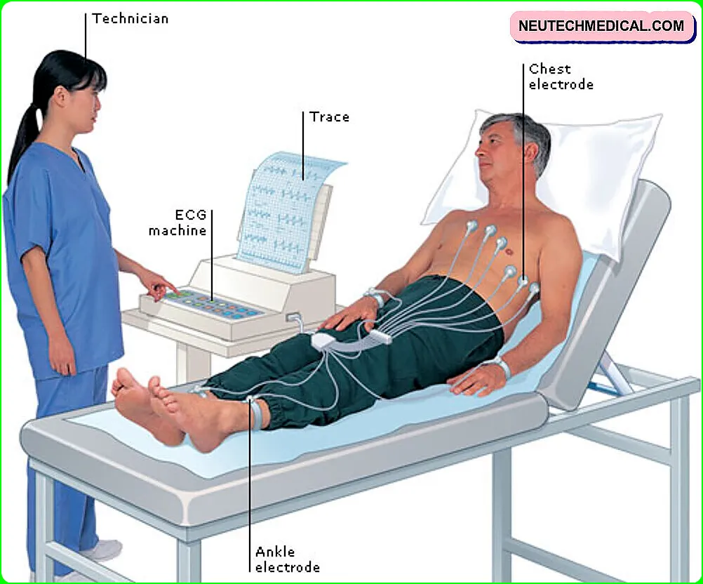 Electrocardiogram ECG