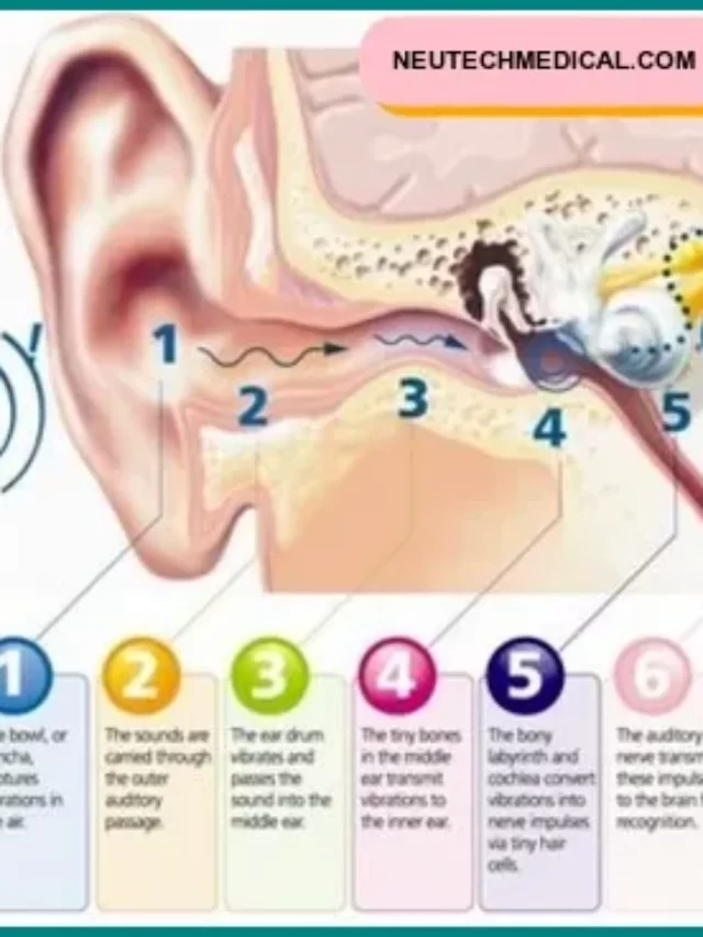 audiometry used for