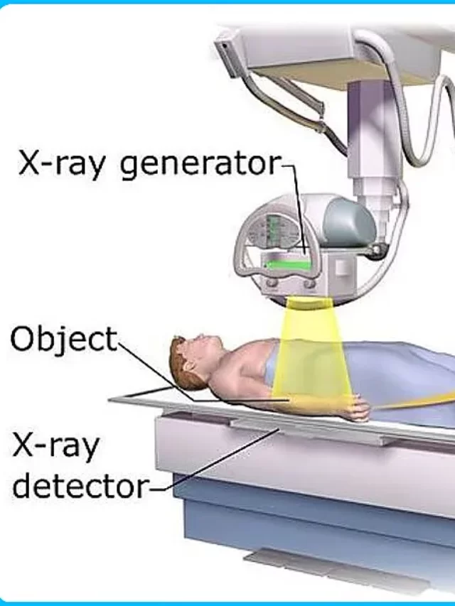 cropped-X-Ray-Machine5.webp