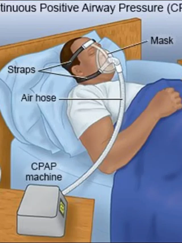 What is the CPAP Machine: how to work, advantage disadvantage
