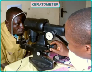 keratometer, keratometry,manual keratometer, what is keratometer, What is Keratometry