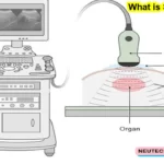 Can we eat before sonography?