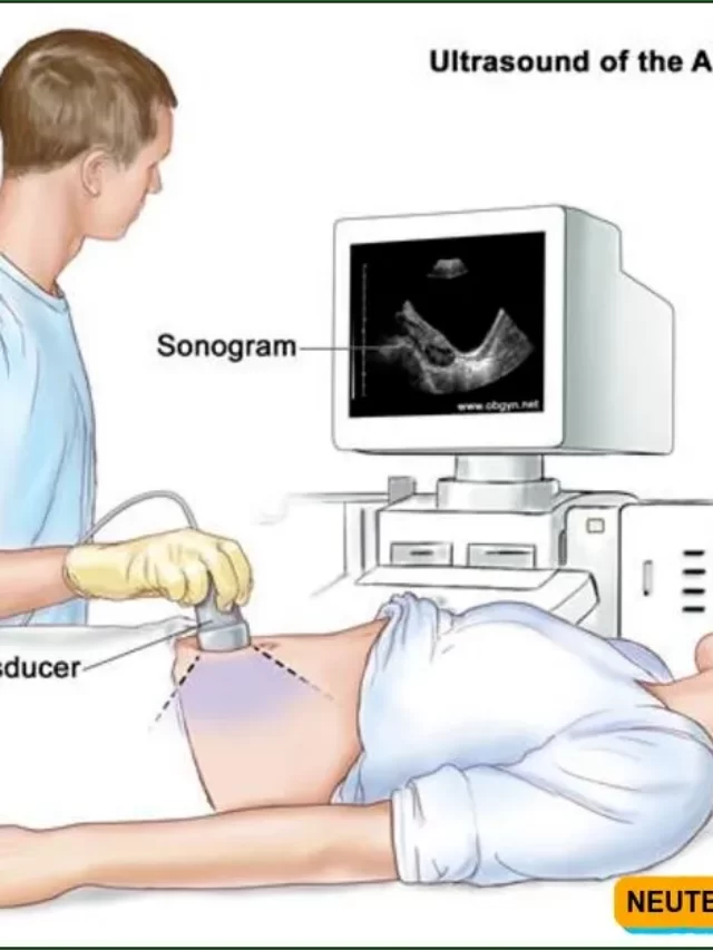 What is sonography, How does Sonography Work, what is Sonography Program, What is Sonography test, What is Sonography Used for,