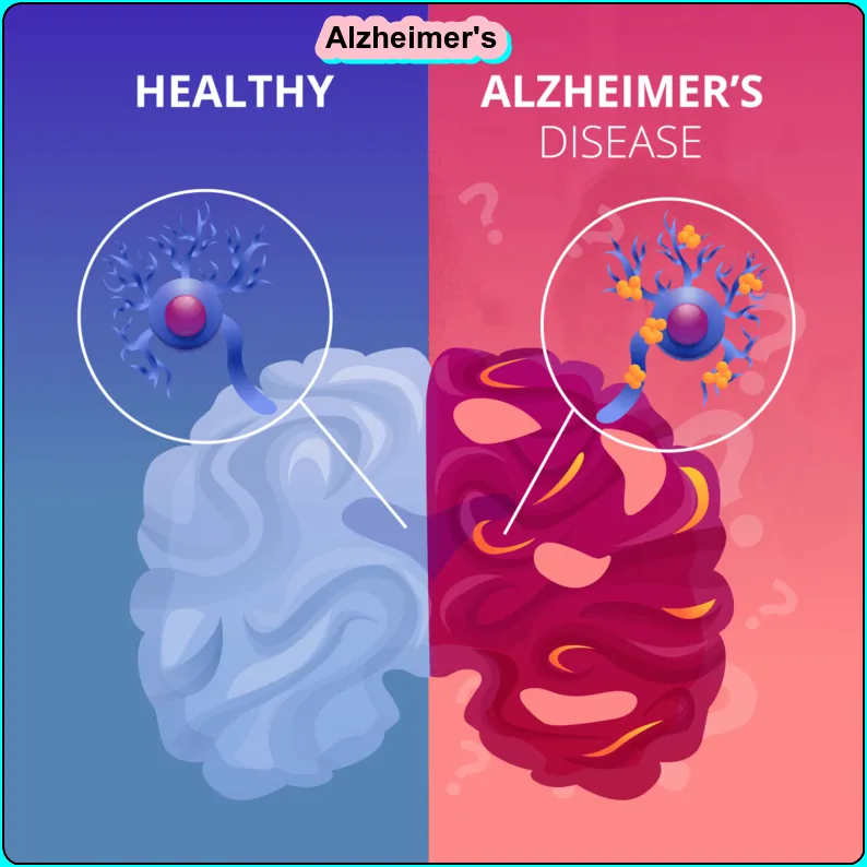 Early signs of alzheimer’s This new Best Technology 2024 aims to detect