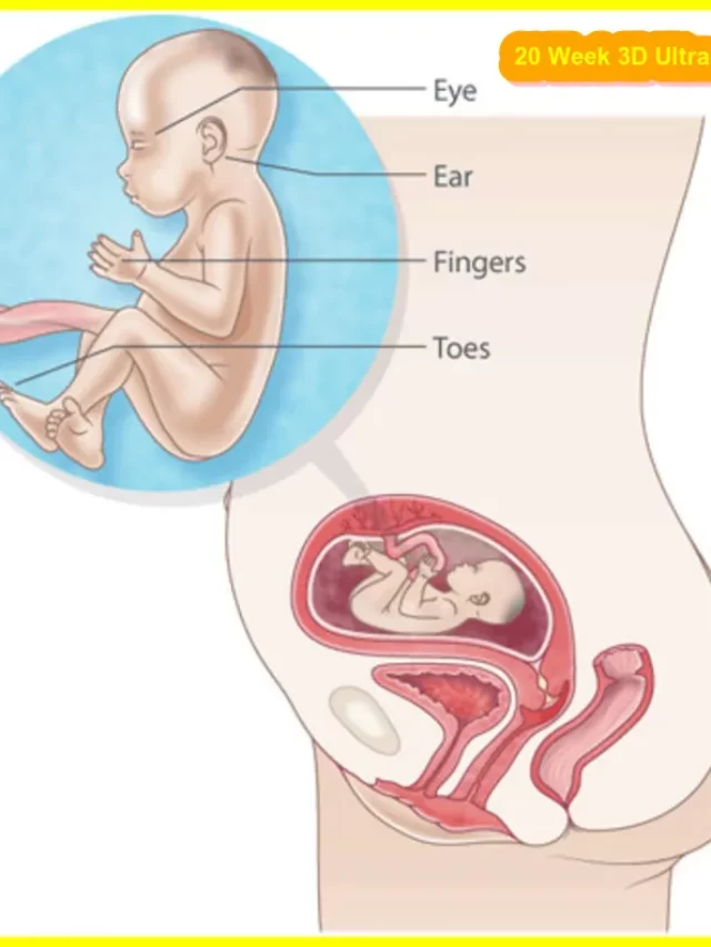 20 Weeks 3D Ultrasound, 20 week 3d ultrasound pictures, 20 week 3d ultrasound face, 20 week 3d ultrasound down syndrome,