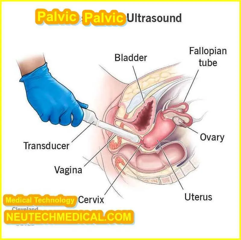 Normal vs Abnormal Pelvic Ultrasound, Signs of a Bad Pelvic Ultrasound, What is a Pelvic Ultrasound, Can a Pelvic Ultrasound Detect Cancer. Pelvic Ultrasound Tool