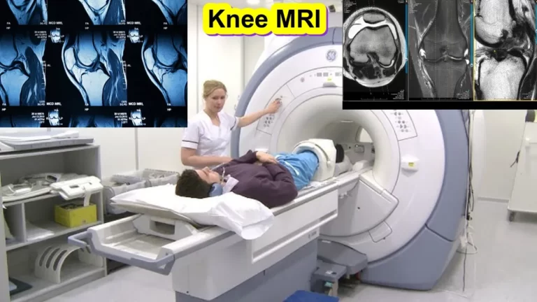 Knee MRI