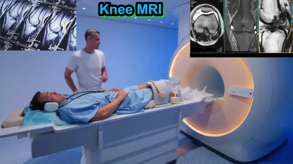 Knee MRI