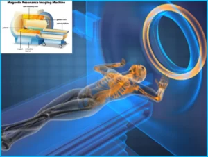 How Long does an MRI Take Hip