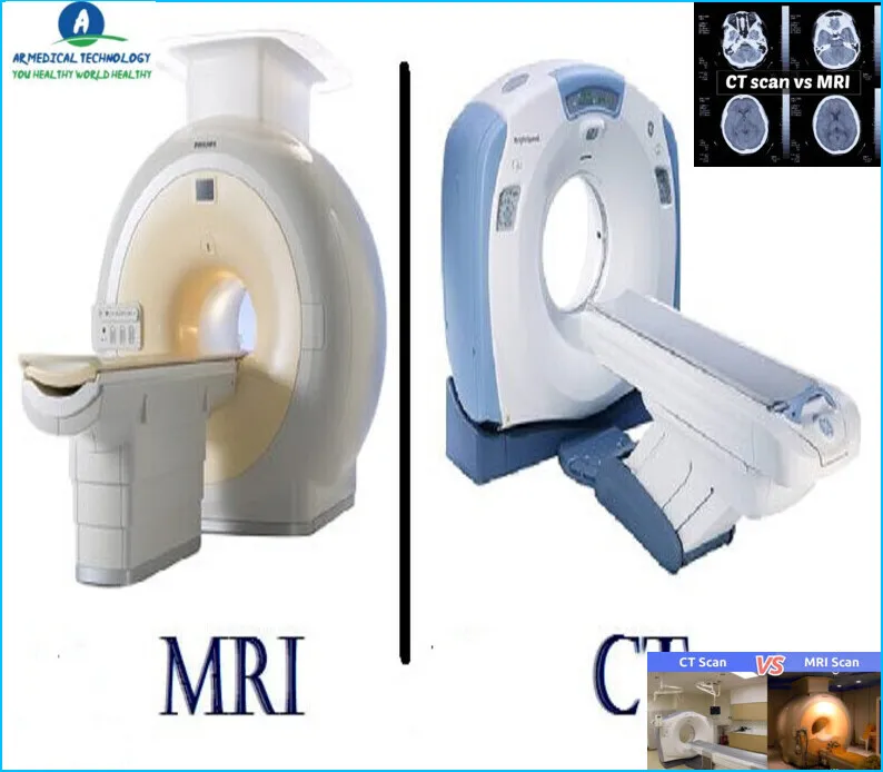 MRI Vs CT Scan
