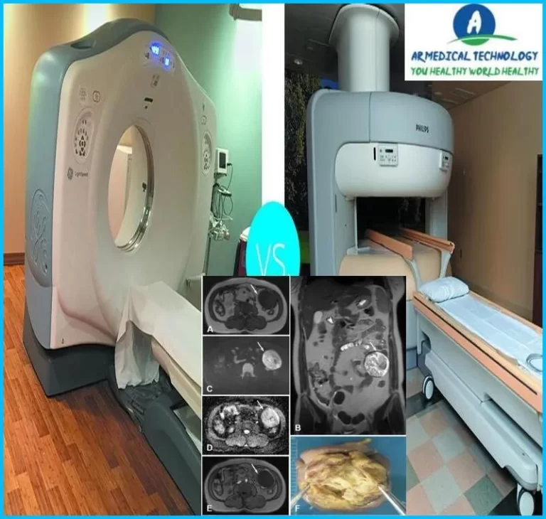 ct scan vs mri for abdomen