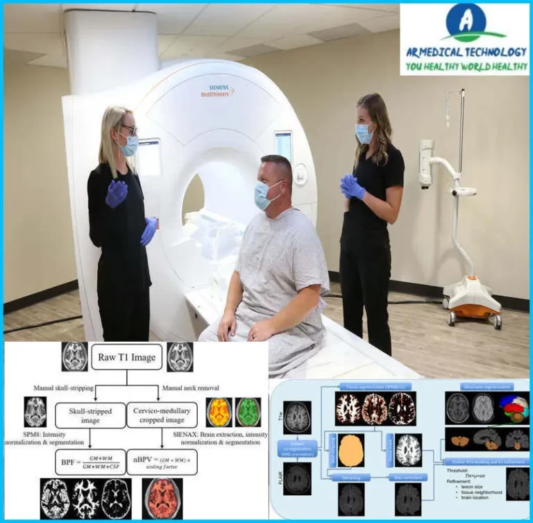 healthy normal vs ms brain mri images