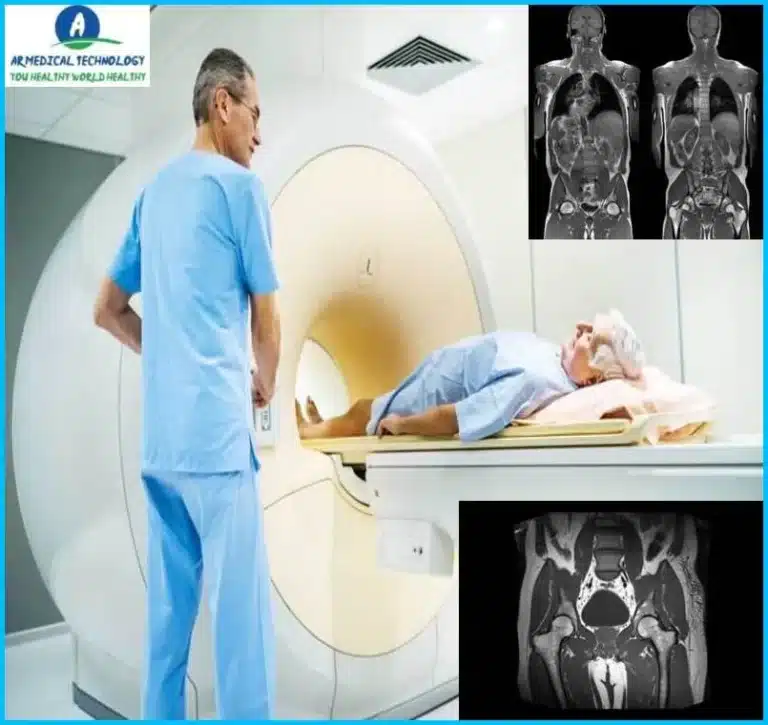 How Long does an MRI Take Hip