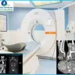 MRI Vs CT Scan Abdomen