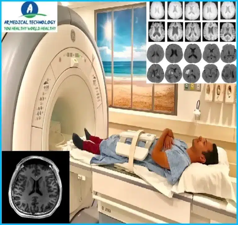 Normal Brain MRI Images