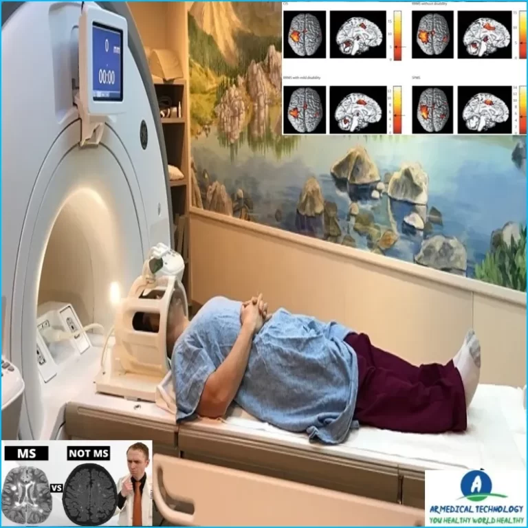 normal vs ms brain mri images