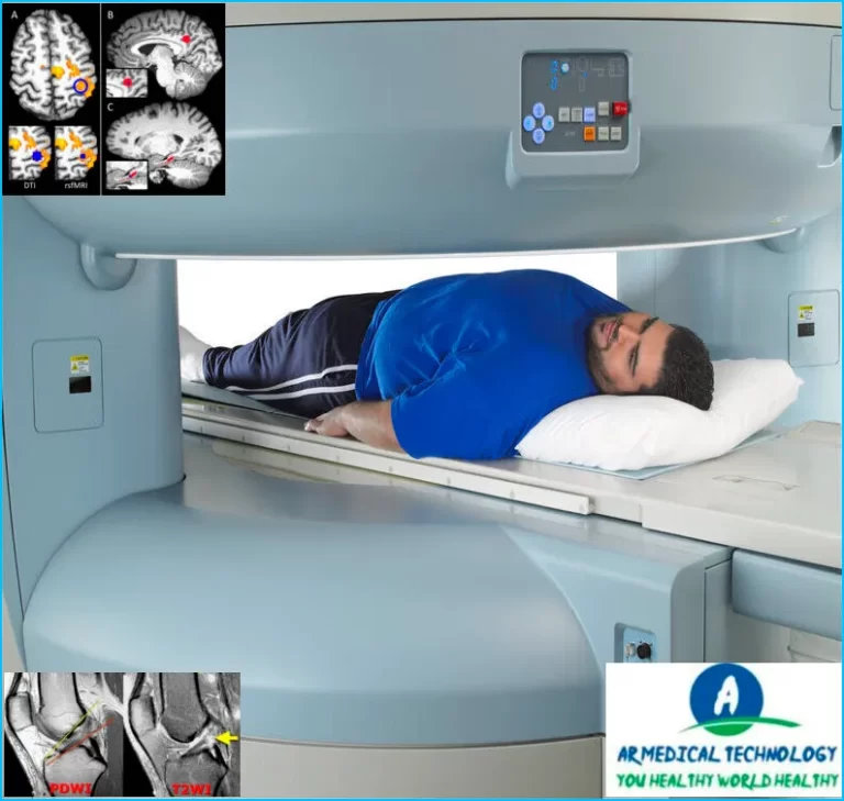 open mri machine