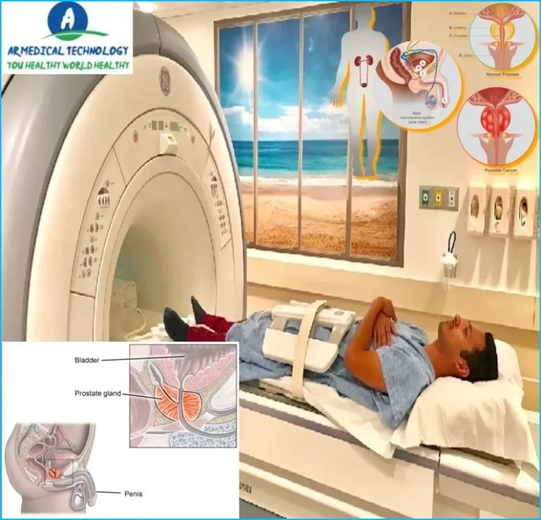 prostate mri