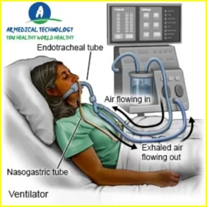 Pulmonary Ventilator