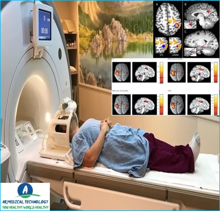 white spots on brain mri