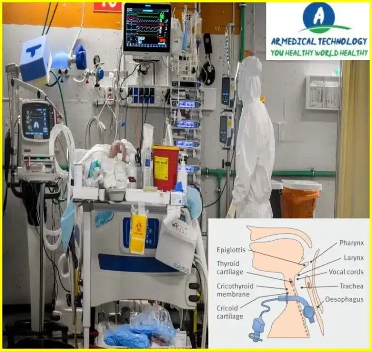 Respirator Vs Ventilator