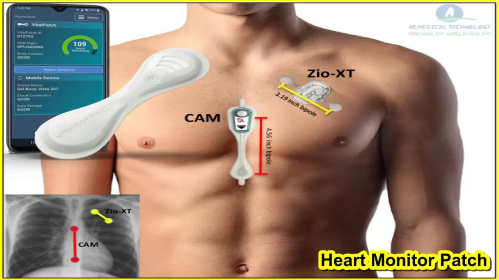 Heart Monitor Patch