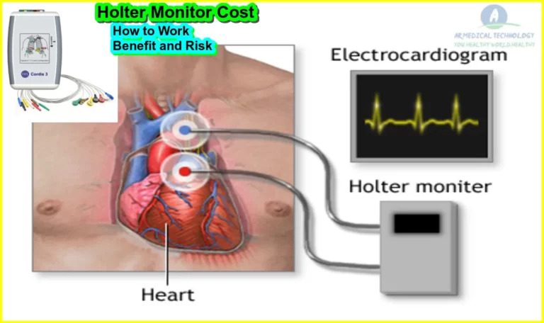 Holter Monitor Cost