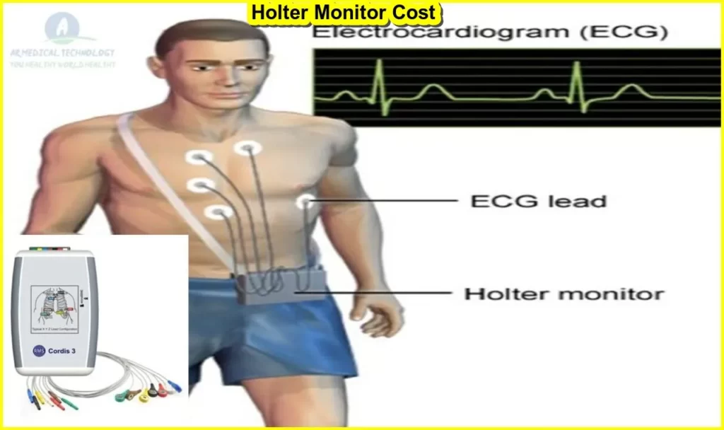 How Much Holter Monitor Cost How To Work, Best Benefit And Risk 24