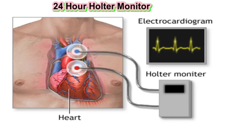 24 Hour Holter Monitor