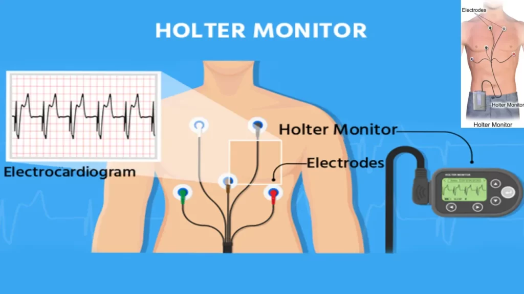 24 Hour Holter Monitor