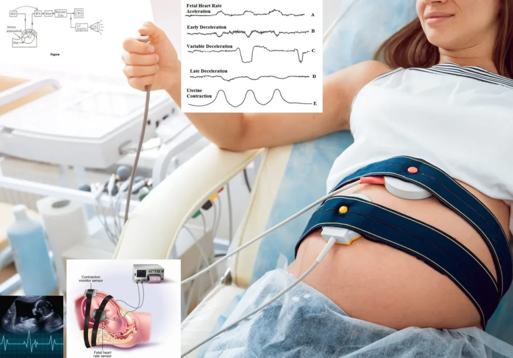 Fetal Heart Monitor