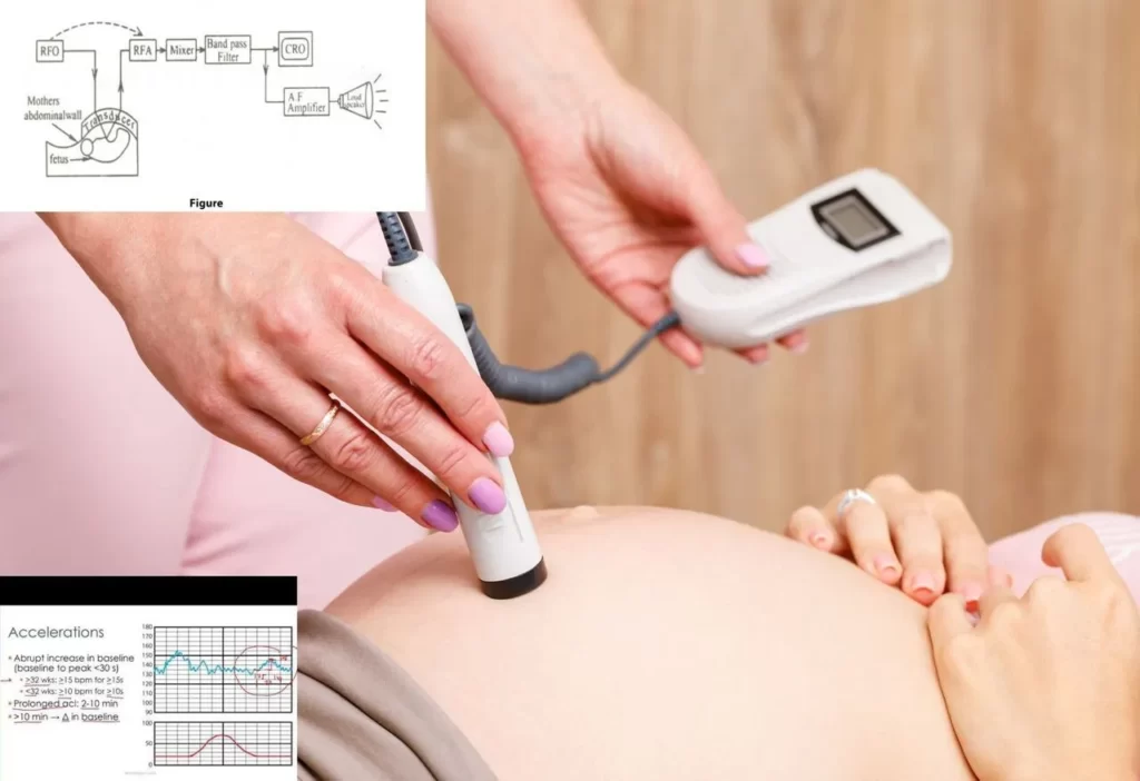 Fetal Heart Monitor