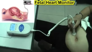 Fetal Heart Monitor