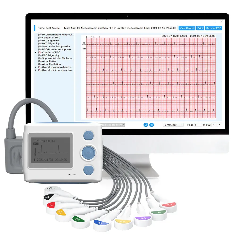 Heart Monitor on Chest