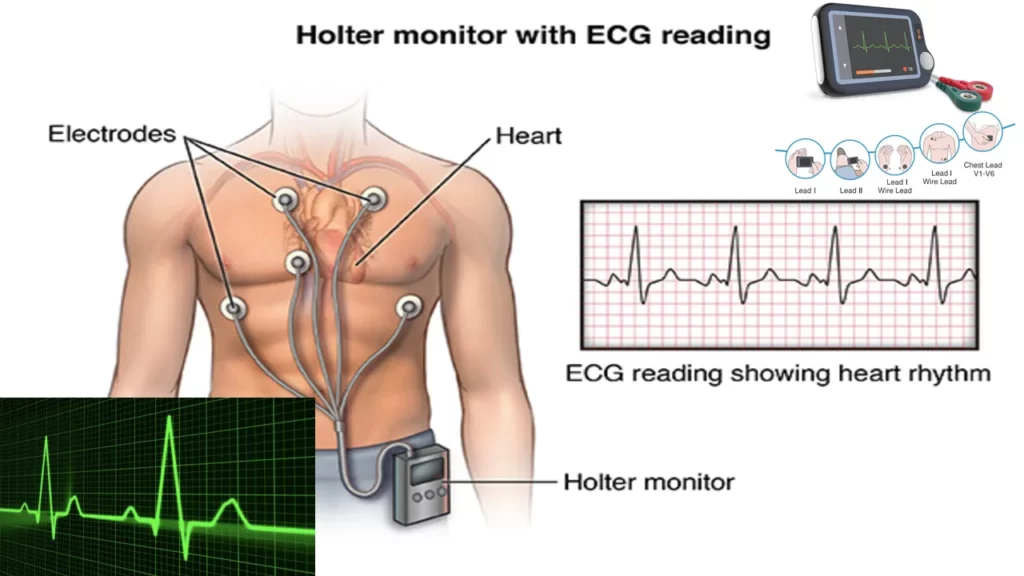 Heart Rate Monitor