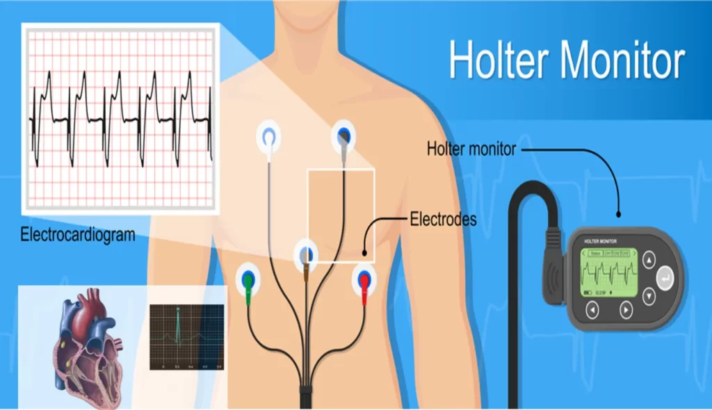 Holter Monitor