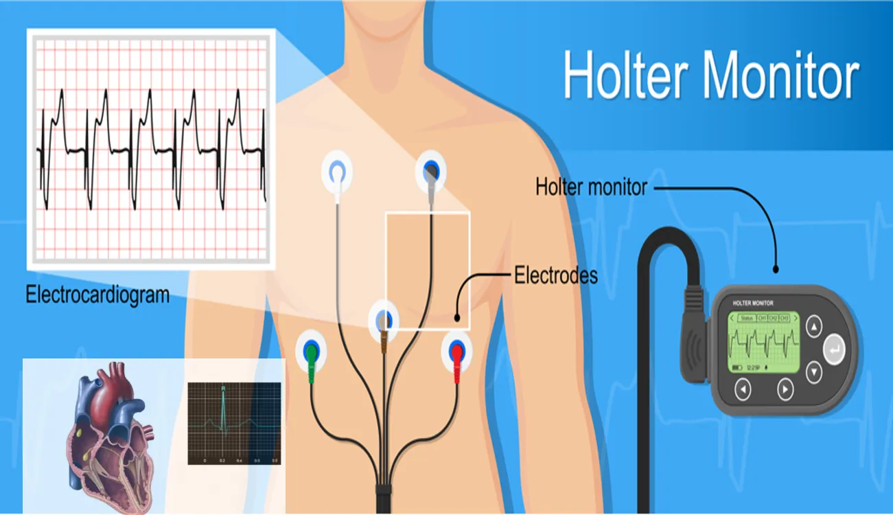 Holter Heart Monitor: Purpose of Monitoring, Best Procedure 24