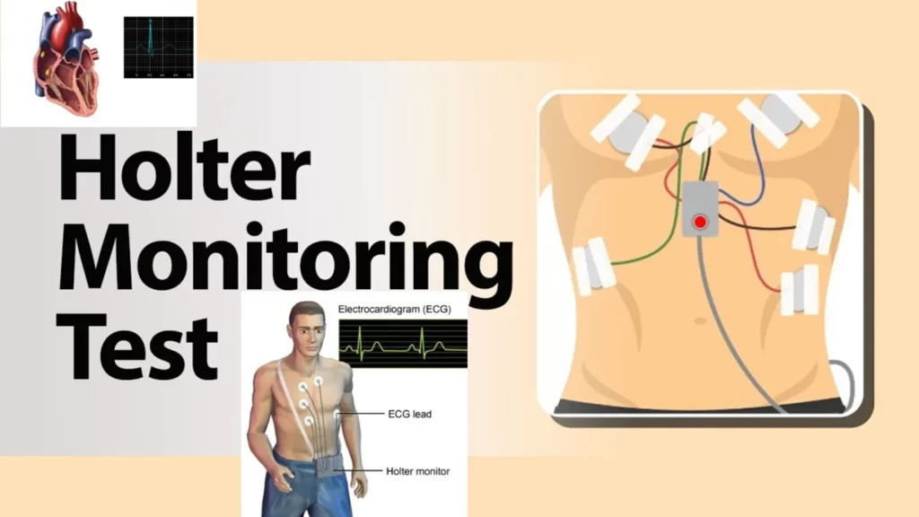 Holter Monitor