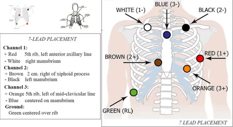 Holter Monitor Instructions