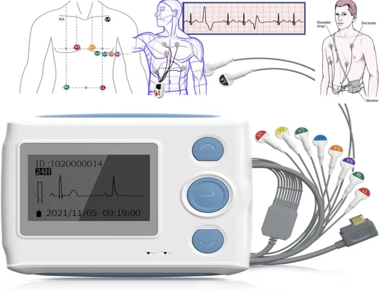 Holter Monitor