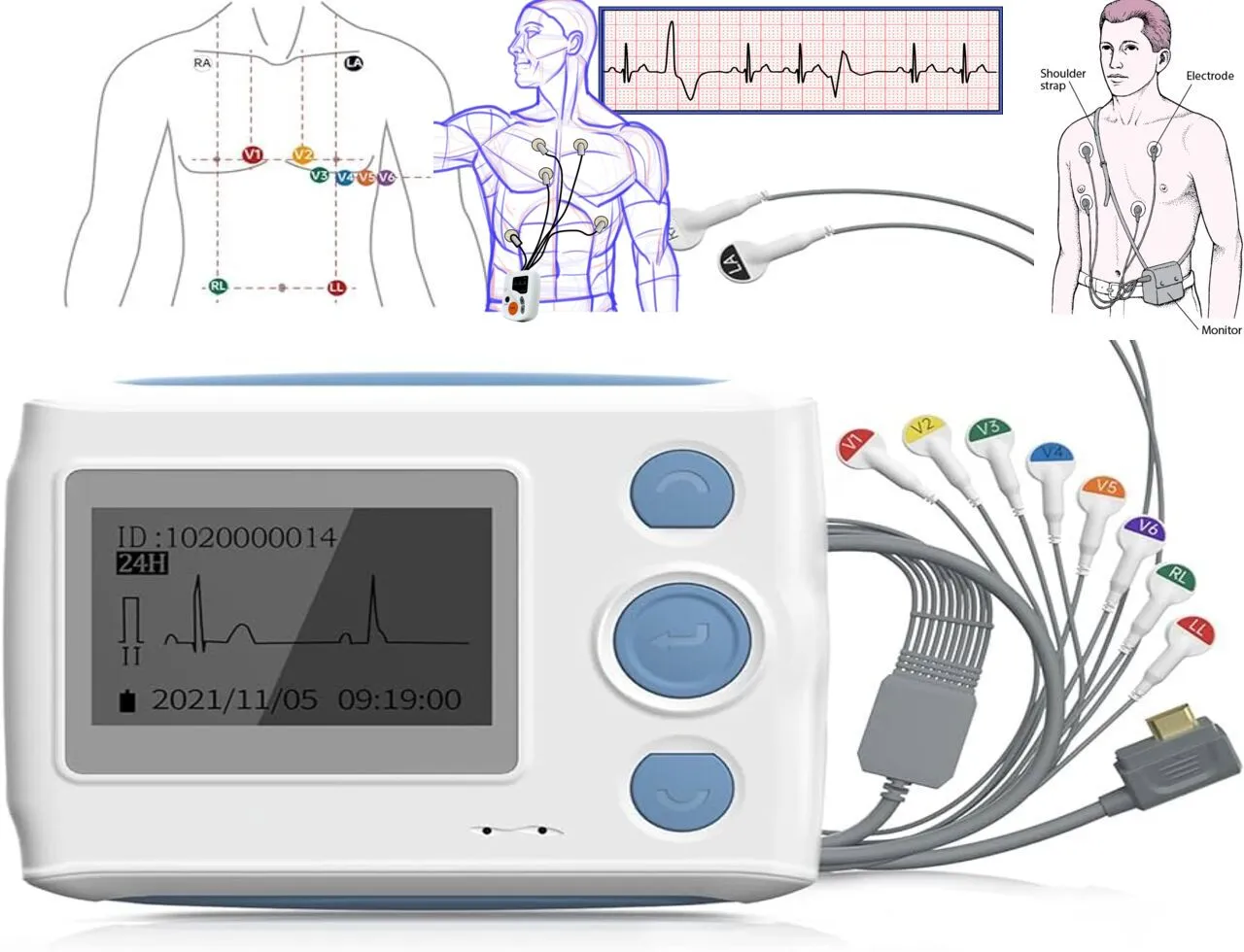 What is the Holter Monitor: Working Principle, Best Uses and Types 24