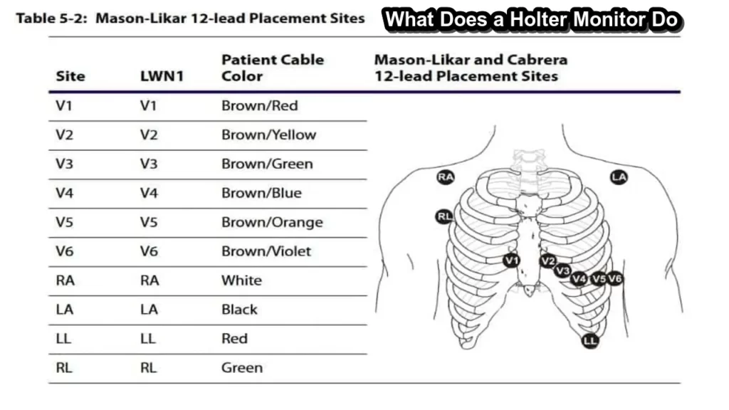 What Does a Holter Monitor Do