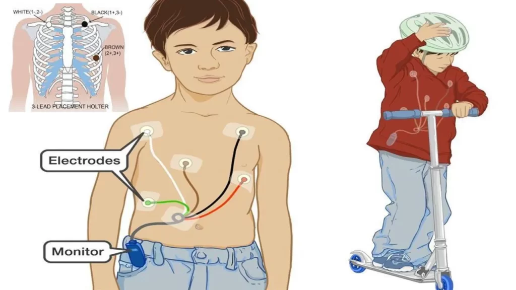 What Does a Holter Monitor Do